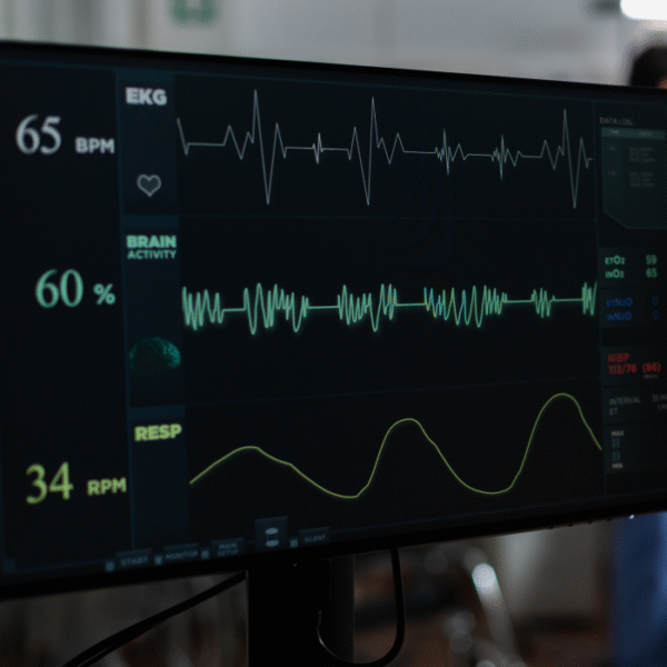 Electrocardiogram (ECG)